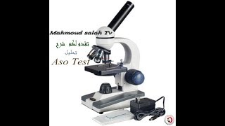 شرح تحليل الميكروب السبحى (  Aso Test ) وكيفية عمل التحليل فى المعمل