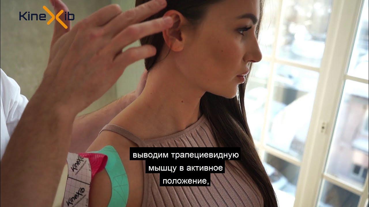 Тейпирование при растяжении плеча - YouTube