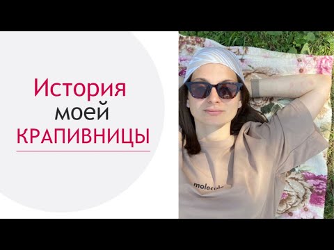 Крапивница.Моя история.Как жила и как боролась с ней.