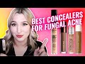 WHAT CONCEALER IS SAFE FOR FUNGAL ACNE? | NYX, Benefit, Fenty, Hourglass - Which one is best?