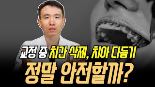 교정 중 치간삭제/치아 다듬기, 부작용은 없을까?