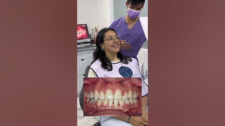 New Smile!