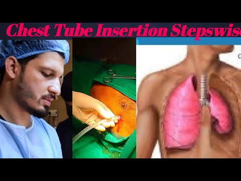 chest tube placement Stepwise/NLE/PMDC\FCPS MS IMM/triangle of safety/Tube thoracostomy