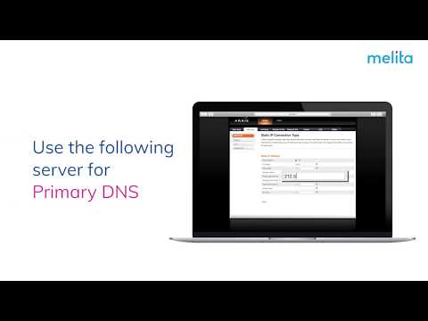 How to configure your static IP on Arris modem