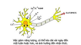 [Vietsub] 2-Minute Neuroscience: Concussions / Series 2-phút với Khoa học Thần kinh: Chấn động não