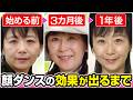【保存版】顔ダンスの効果が出るまで半年~5年後の変化まとめ【Before After】