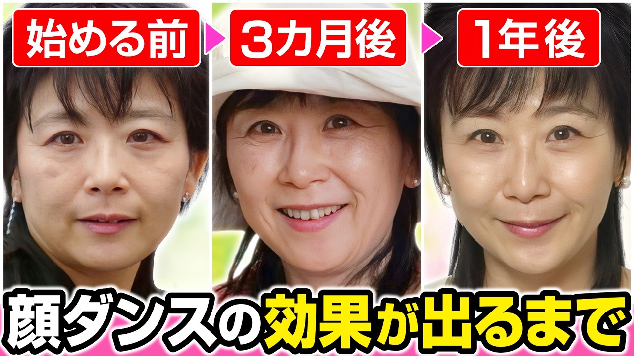 【保存版】顔ダンスの効果が出るまで半年~5年後の変化まとめ【Before After】