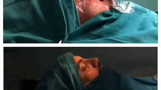 Kamil Ceferov. Rinoplastika