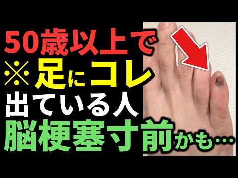 [Check Your Feet Now] 10 Signs That Appear on Almost Everyone's Feet Right Before Brain Vessels R...
