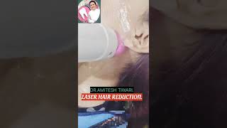 Neck Facial laser hair Reduction viral music song trending shortvideo