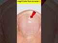 न ख न म सफ द न श न क मतलब Shorts Viral Nails न ख न म सफ द न श न क मतलब Shorts Viral Nails