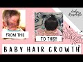 BABY HAIR GROWTH TIPS 2021 | BABY HAIR LOSS, CRADLE CAP, FOLLICULITIS + MORE!