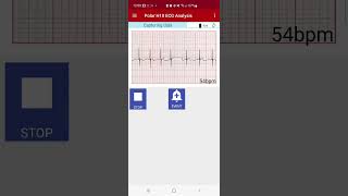 Polar H10 ECG Analysis from Biosignal Solutions on Android screenshot 4