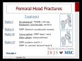 Millers 2016 orthopaedics trauma lower extremity