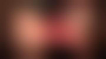 Extraction #7 with Socket Grafting using Cytoplast d-PTFE & Mineross, Full Video