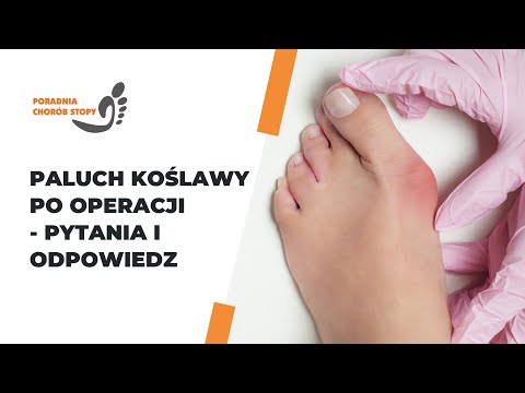 Wideo: Jak wyzdrowieć po operacji stopy (ze zdjęciami)