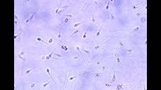 Sperme Humain Au Microscope Optique Human Sperm Under Optical Microscope Youtube