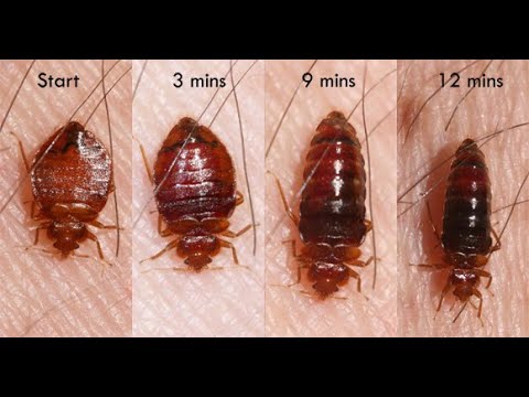 MAGICAL  METHODE TO GET RID OF BEDBUGS UN UGANDA