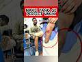 Walk With Artificial Leg #ossur #artificialleg #prostheticlimb #foryou #shortvideo #ytshorts #fypp