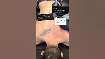 Before And After Laser Tattoo Removal Lasertattooremoval Lasertattooremoval Beforeandafter 