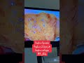 فرصة اكبر للعلاج الدوائي احمد نمر الخطيب متلازمة كلاينفلتر صفر حيوان منوي بحث مجهري