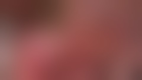 Inferior Hypogastric Nerve and Plexus Endometriosis, 97s