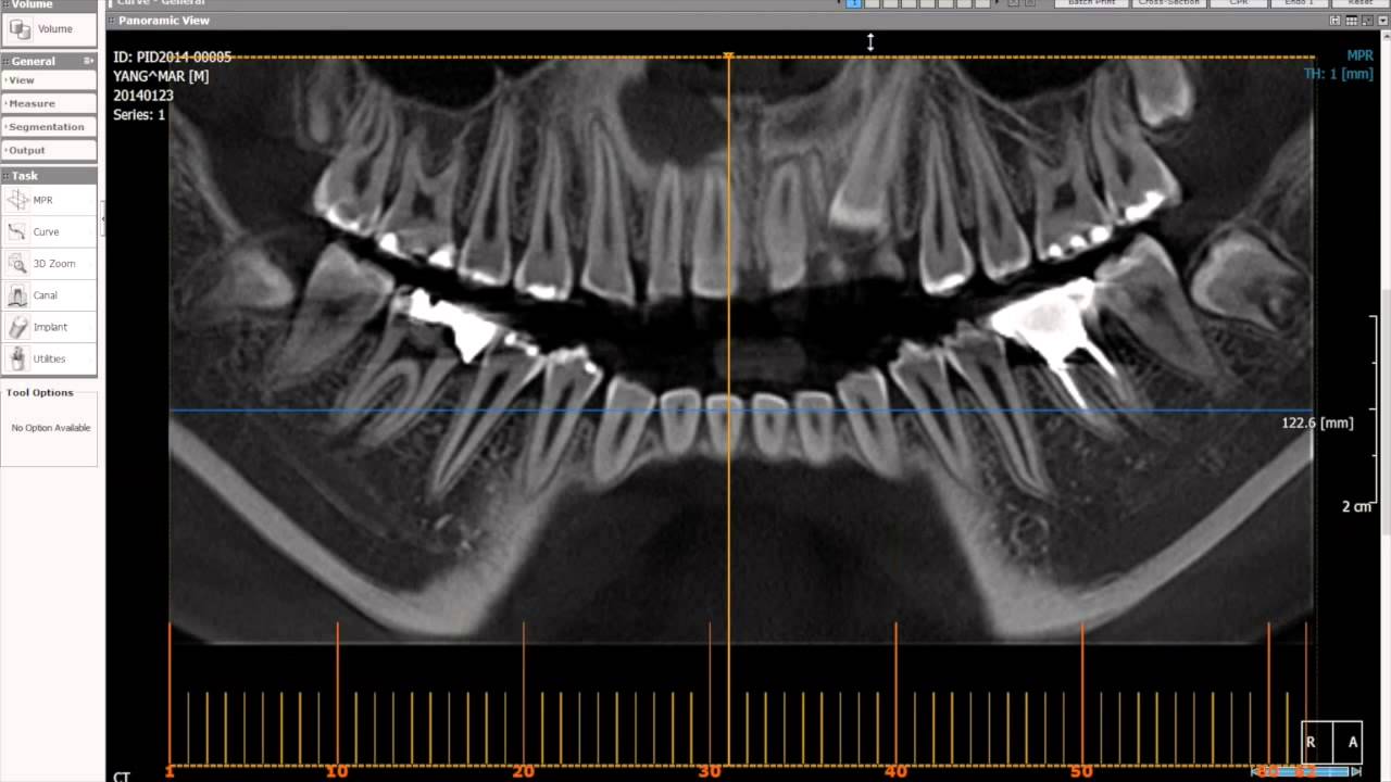 xelis dental cd viewer