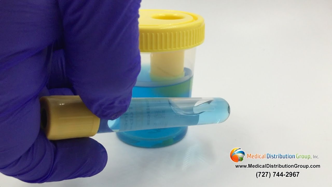 Vacuum Urine Collection Cups Vacuum Urinalysis Tubes 10mL or 5mL