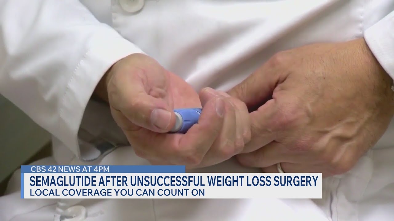 semaglutide longevity news Semaglutide after unsuccessful weight loss surgery
