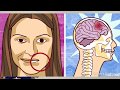 Accidente cerebrovascular 🧠 fisiopatología del ACV isquémico y hemorrágico fácil de aprender! Ictus