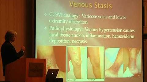 Dr. Gooding Lecture Part 1 - Hubbard Foundation 2011 CCSVI Conference