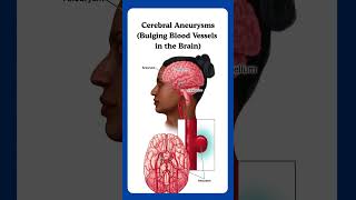 Skull Base Surgery Dr. Manthan Patel : Vaishvi Brain & Spine Neurosurgical Hospital, Ahmedabad