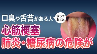 【ドクター監修】口臭や舌苔がある人、放っておくと、肺炎・心筋梗塞・糖尿病の危険が