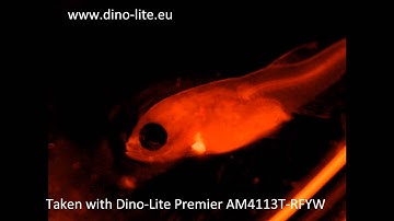 Fluoresence Dino-Lite Microscopes