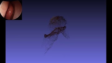 Self-supervised Learning for Dense Depth Estimation in Monocular Endoscopy