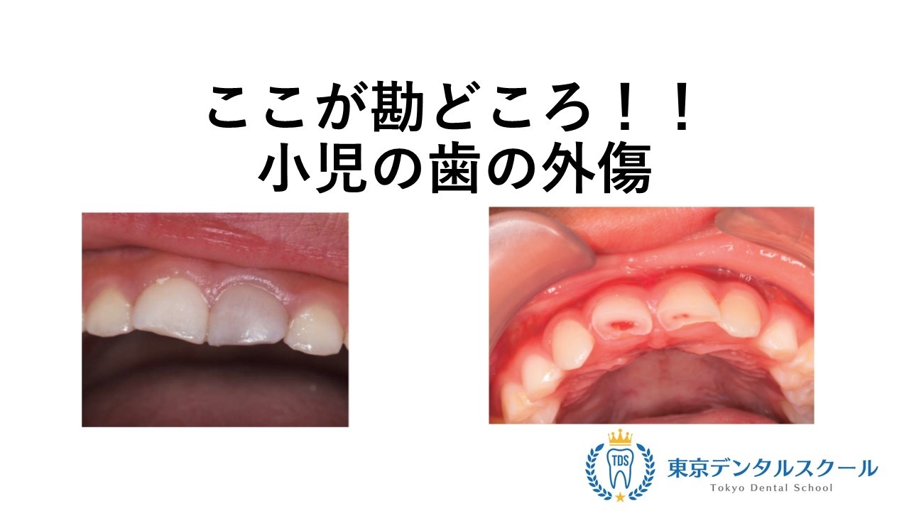 歯科医師国家試験合格個別指導予備校 東京デンタルスクール