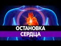 ОСТАНОВКА СЕРДЦА. ИНФАРКТ. СЕРДЕЧНЫЙ ПРИСТУП.