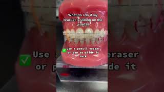 Broken Brackets!! 😭🥺#orthodontist