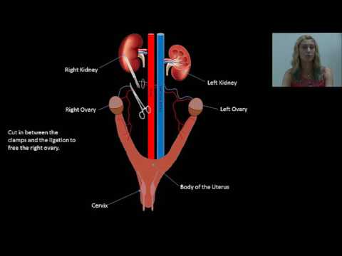 Small Animal Spay Procedure Youtube Small Animal Spay Procedure Youtube