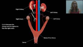 Small Animal Spay Procedure