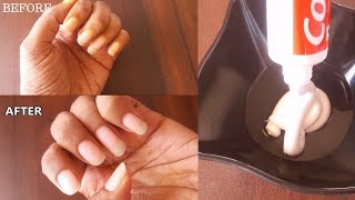 OMG! I Apply Toothpaste On My Nails and See The Magic | Toothpaste Hack | whiten nails