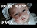 【生後100日】大手術を乗り越えて/多碑症候群