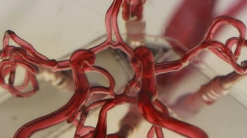 Magnetic microrobots for targeted therapies