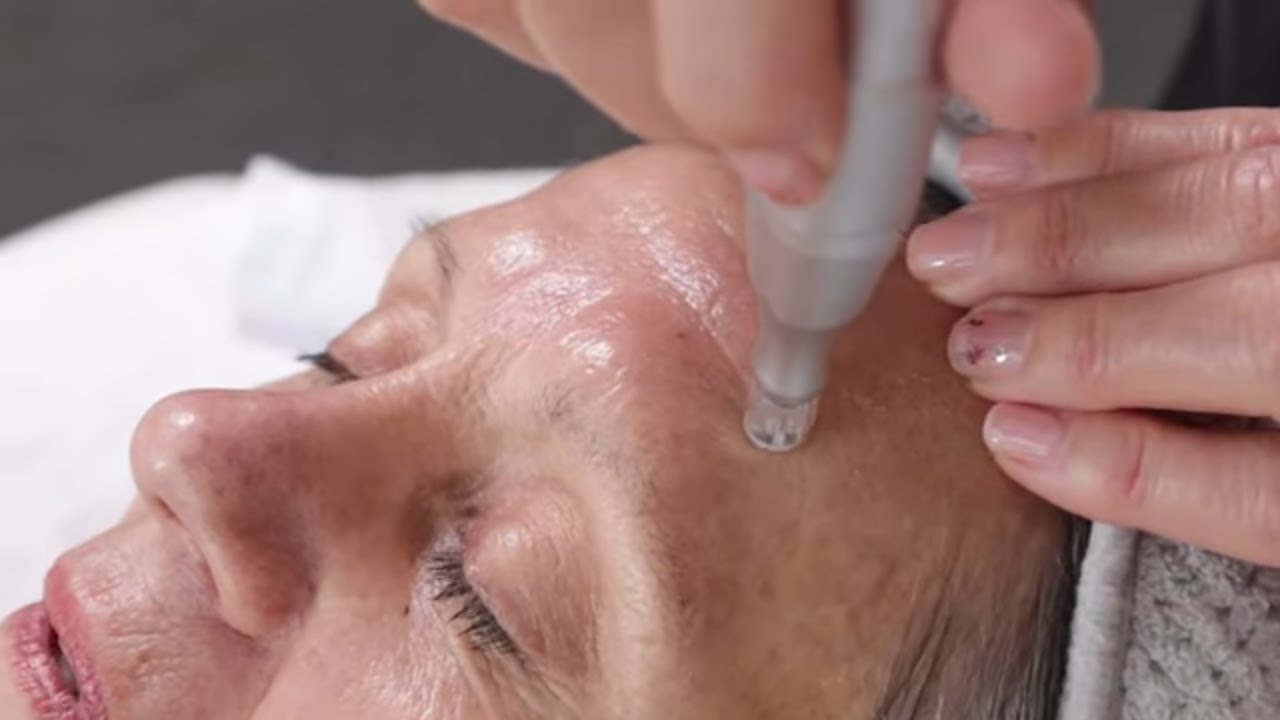 CO2Lift  Pro Carboxy Treatment Mask + Nano Infusion Pen