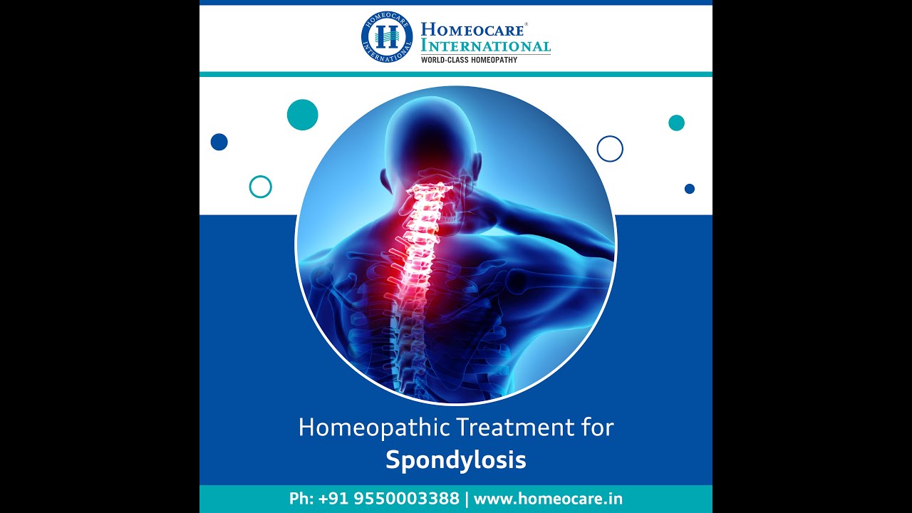 Homeopathy Treatment for Cervical Spondylosis (Tamil) - YouTube