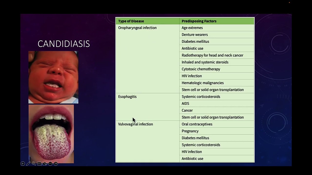 54 - Opportunistic Mycoses Part 01