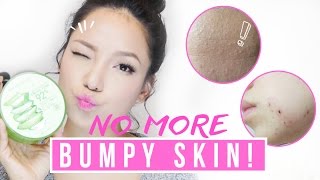 Get rid of Tiny Bumps & Pimples in ONE WEEK (it works!!)