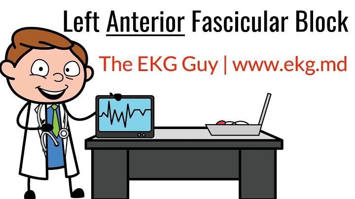 Left Anterior Fascicular Block on EKG / ECG l The EKG Guy - www.ekg.md