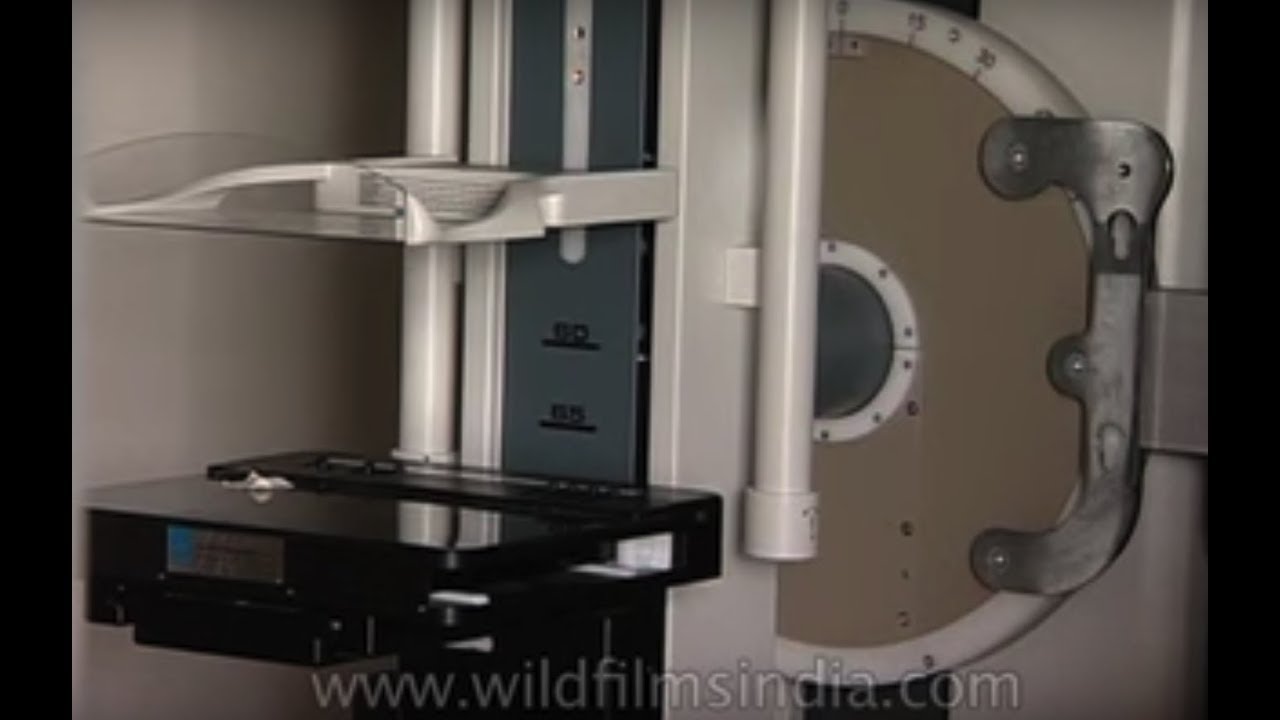 Mammography - breast cancer detection technology in its early days in ...