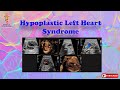 Hypoplastic Left Heart Syndrome